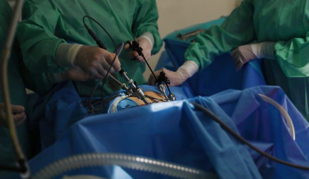 laproscopy